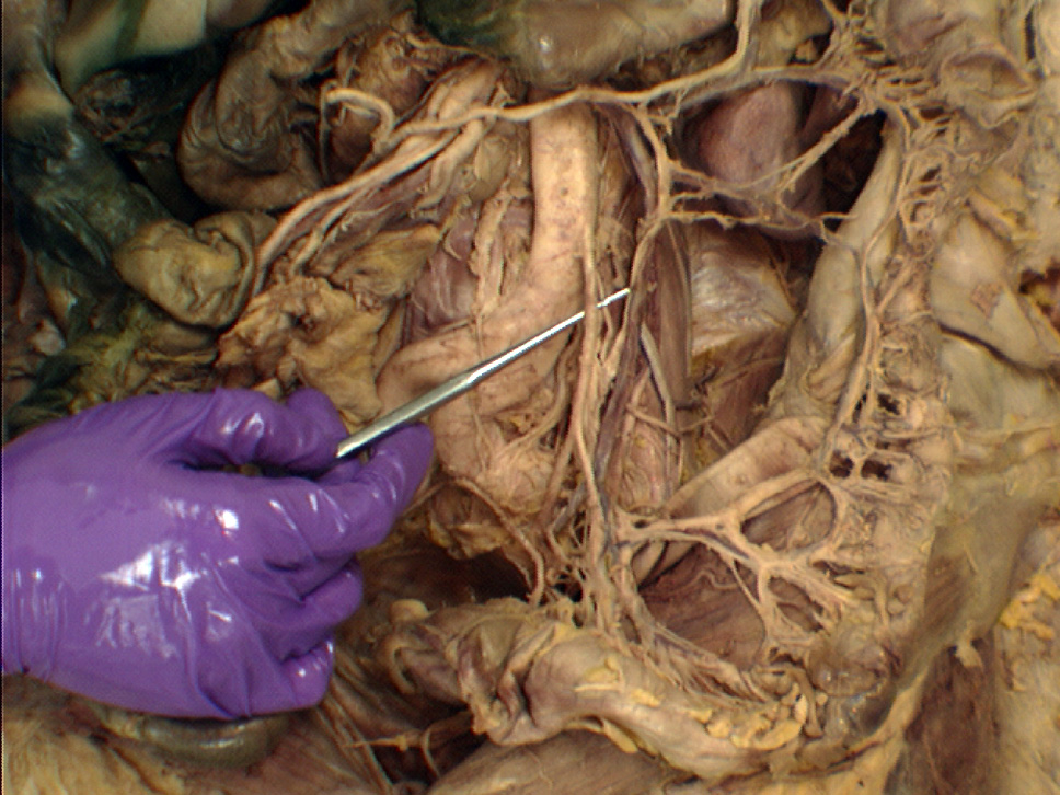 The Body Online - Stony Brook University Department of Anatomy