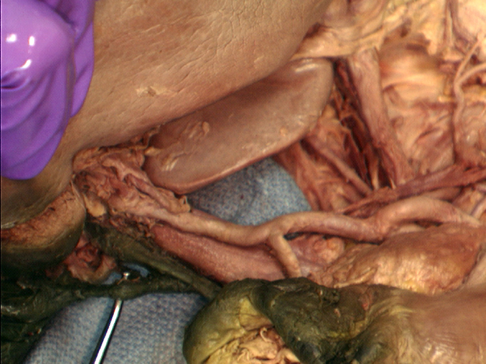 The Body Online - Stony Brook University Department of Anatomy