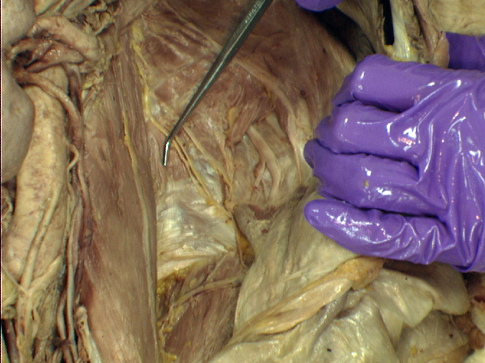 The Body Online - Stony Brook University Department of Anatomy