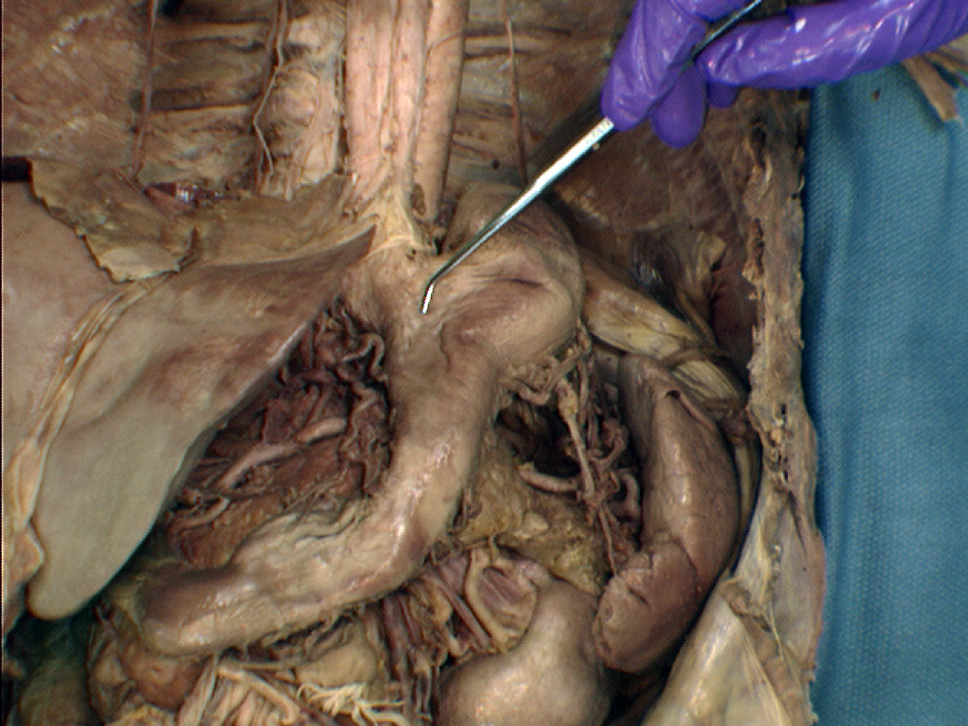 The Body Online - Stony Brook University Department of Anatomy