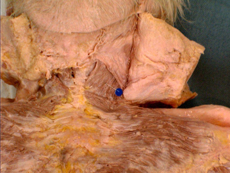 The Body Online - Stony Brook University Department of Anatomy