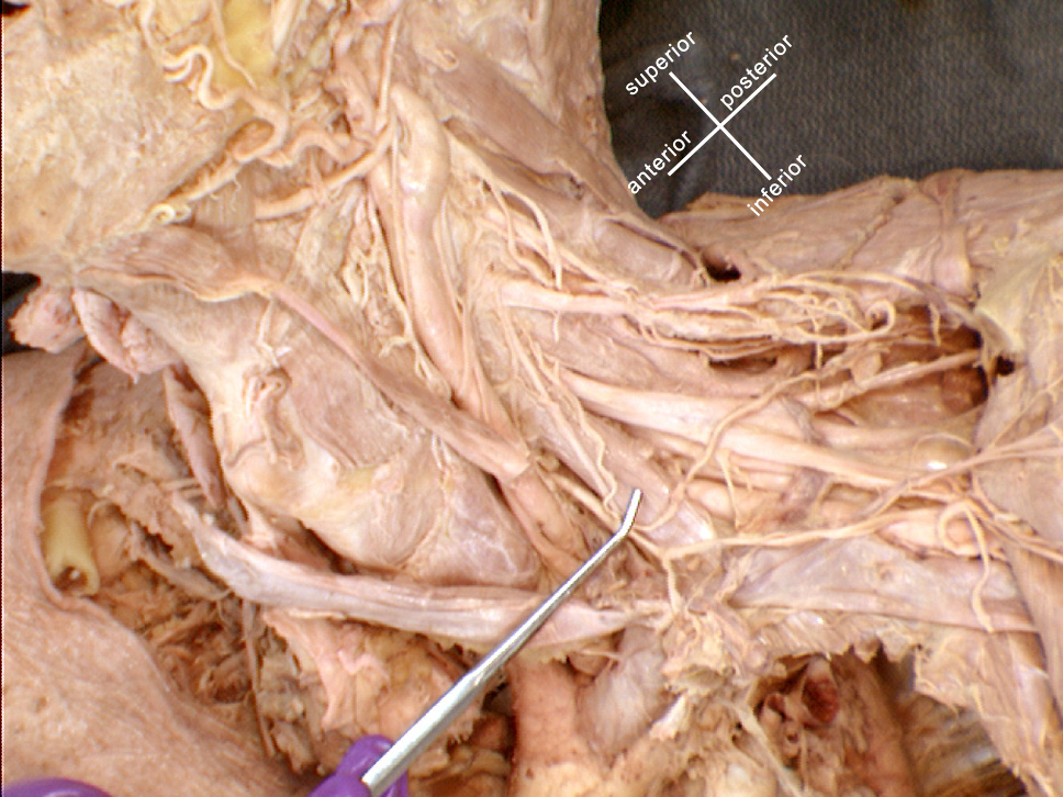 The Body Online - Stony Brook University Department of Anatomy