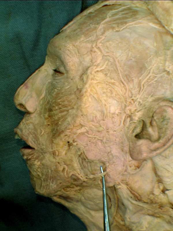 Marginal mandibular branch of the facial nerve - Porn Images Pov porn videos