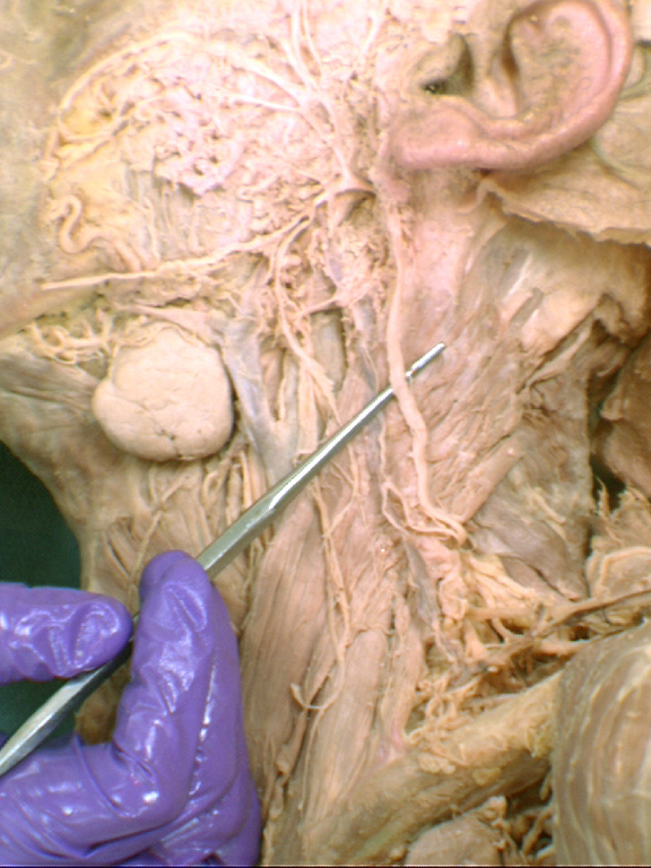 The Body Online - Stony Brook University Department of Anatomy