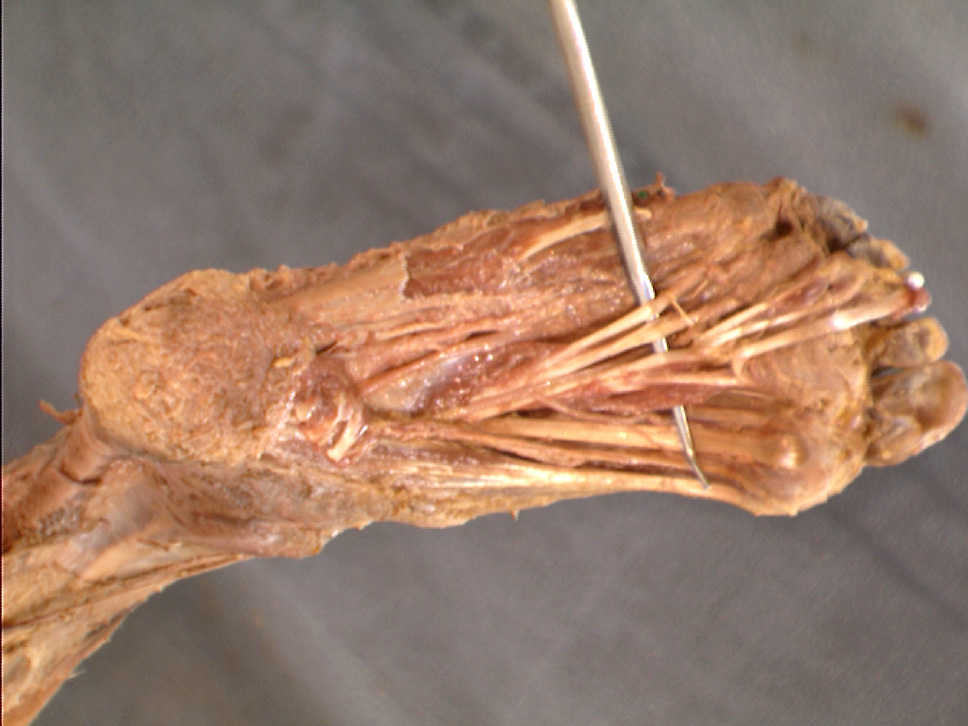 the body online stony brook university department of anatomy