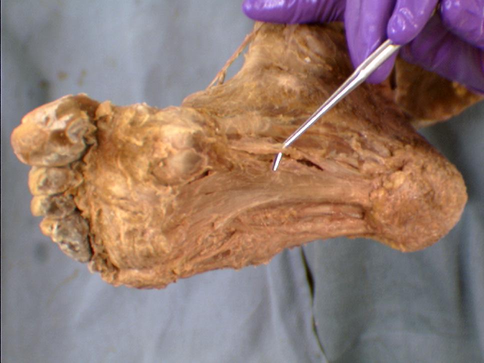 The Body Online Stony Brook University Department of Anatomy