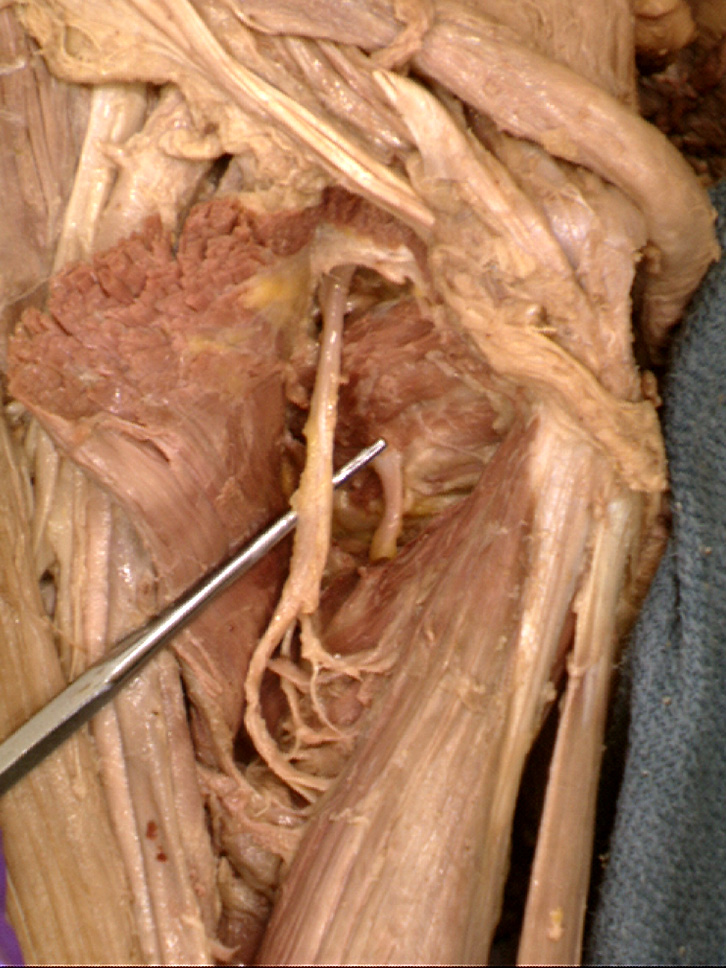 The Body Online - Stony Brook University Department of Anatomy