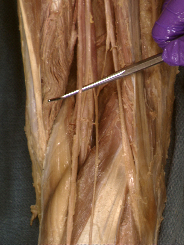 The Body Online - Stony Brook University Department of Anatomy