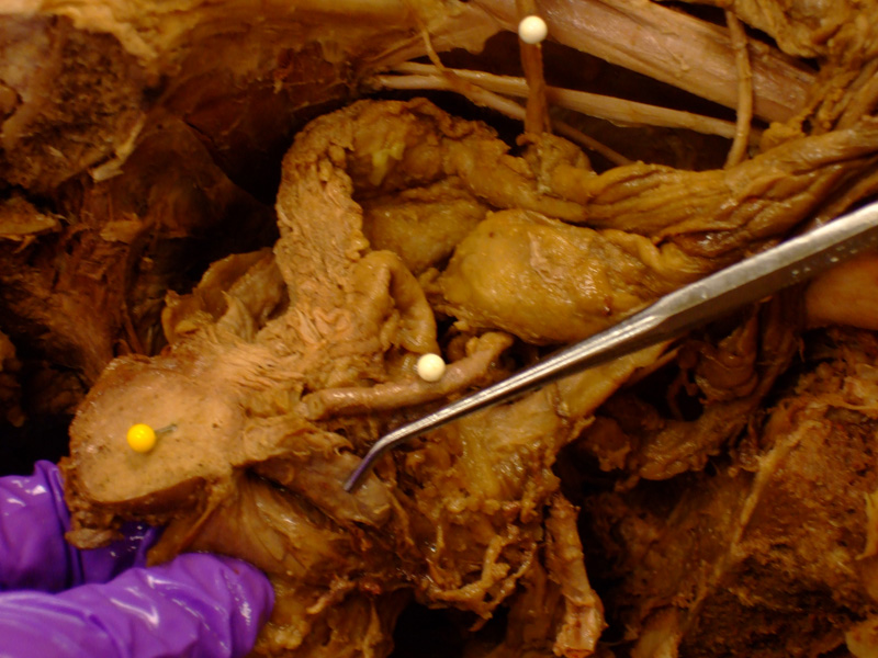 The Body Online - Stony Brook University Department of Anatomy