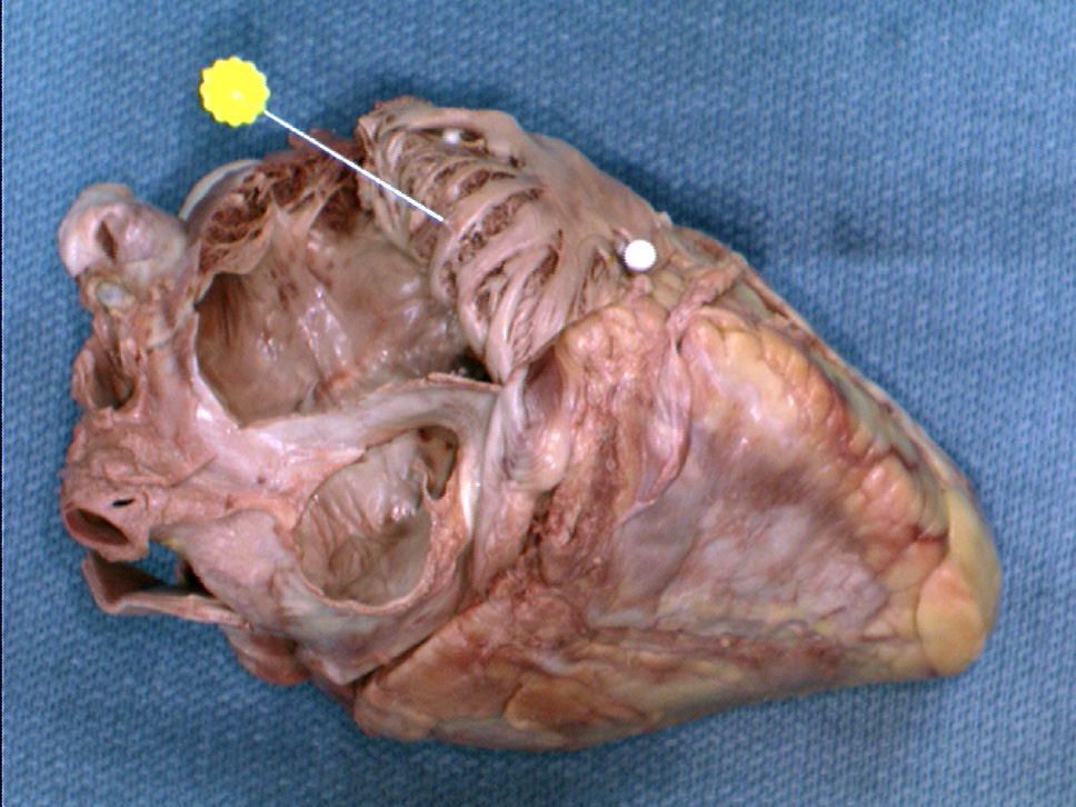 The Body Online - Stony Brook University Department of Anatomy