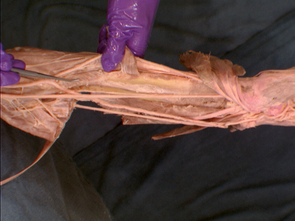 The Body Online - Stony Brook University Department of Anatomy