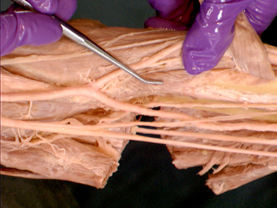 The Body Online - Stony Brook University Department of Anatomy